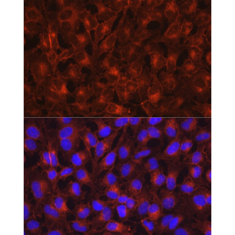 Immunofluorescence - Anti-Axl Antibody (A91665) - Antibodies.com