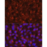 Immunofluorescence - Anti-Axl Antibody (A91665) - Antibodies.com