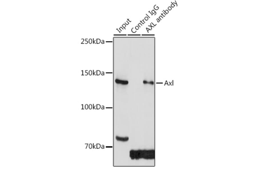Western Blot - Anti-Axl Antibody (A91665) - Antibodies.com