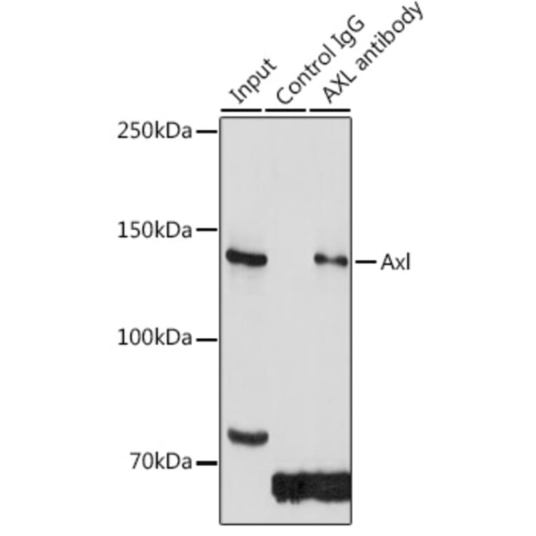 Western Blot - Anti-Axl Antibody (A91665) - Antibodies.com