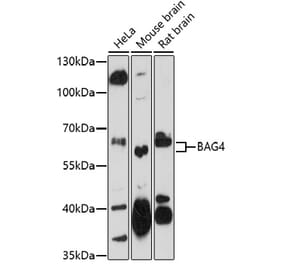 Western Blot - Anti-SODD Antibody (A91666) - Antibodies.com