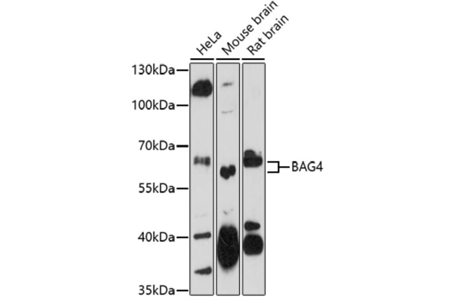 Western Blot - Anti-SODD Antibody (A91666) - Antibodies.com