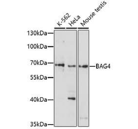 Western Blot - Anti-SODD Antibody (A91667) - Antibodies.com