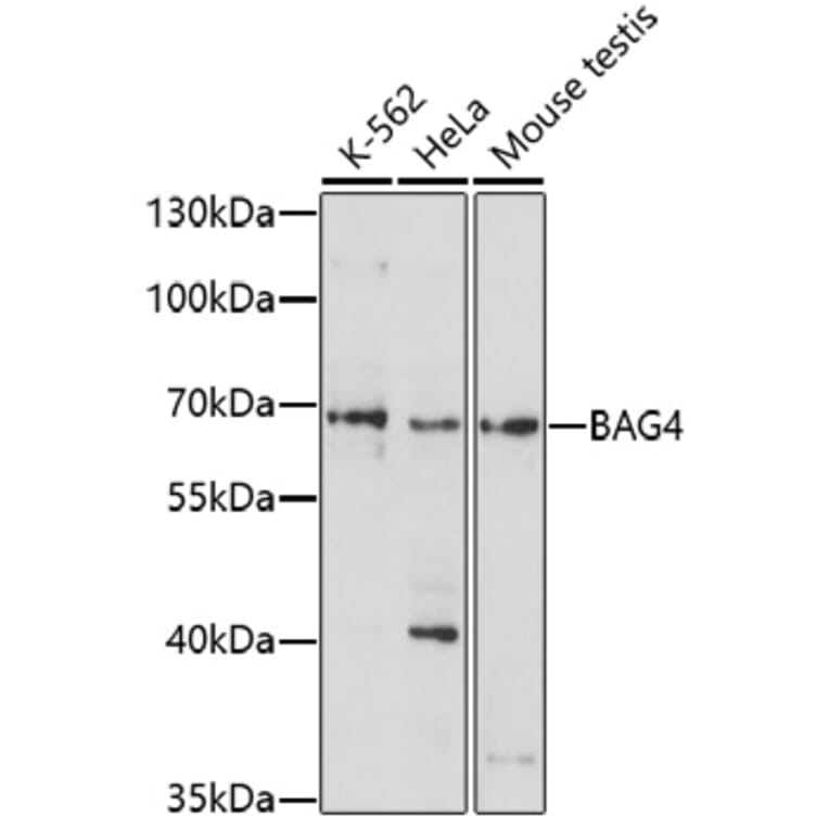 Western Blot - Anti-SODD Antibody (A91667) - Antibodies.com