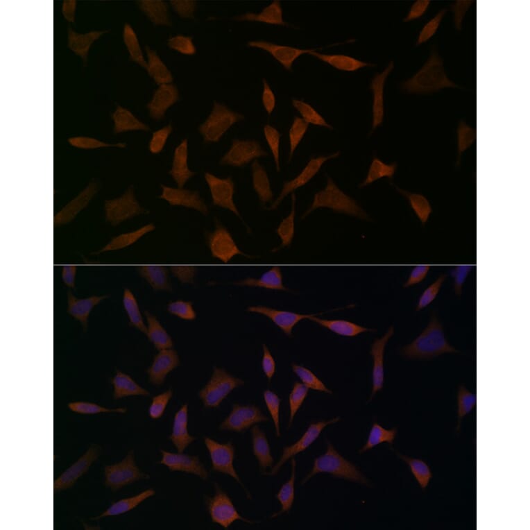 Immunofluorescence - Anti-BCAT1 Antibody (A91668) - Antibodies.com