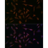 Immunofluorescence - Anti-BCAT1 Antibody (A91668) - Antibodies.com