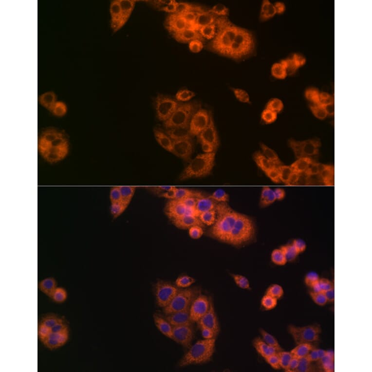 Immunofluorescence - Anti-BCAT1 Antibody (A91668) - Antibodies.com