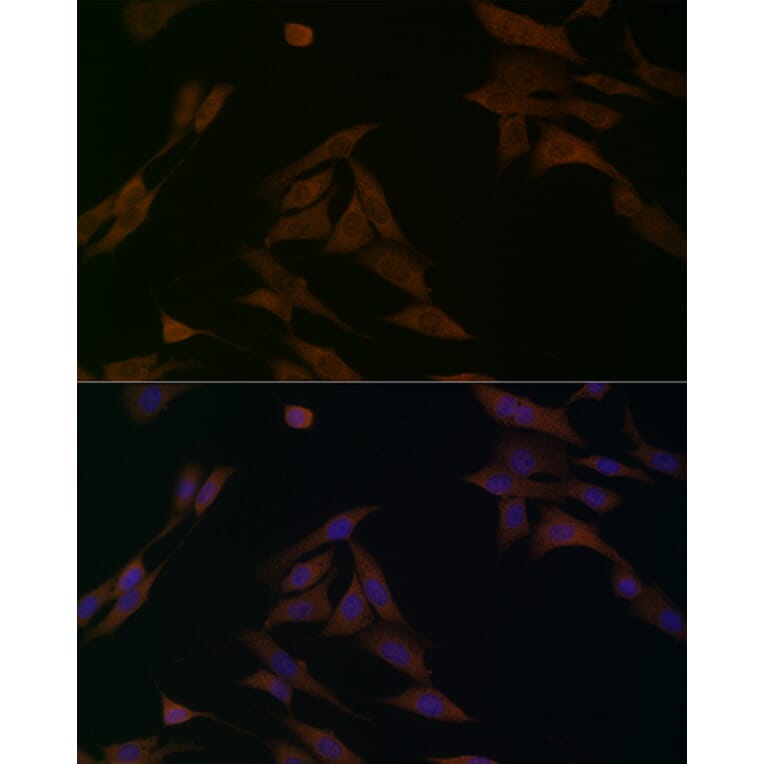 Immunofluorescence - Anti-BCAT1 Antibody (A91668) - Antibodies.com