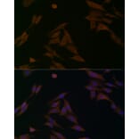 Immunofluorescence - Anti-BCAT1 Antibody (A91668) - Antibodies.com