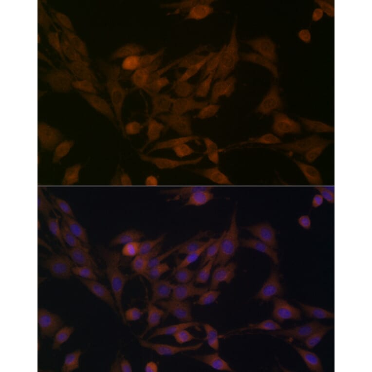 Immunofluorescence - Anti-BCAT1 Antibody (A91668) - Antibodies.com