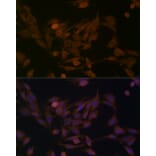 Immunofluorescence - Anti-BCAT1 Antibody (A91668) - Antibodies.com