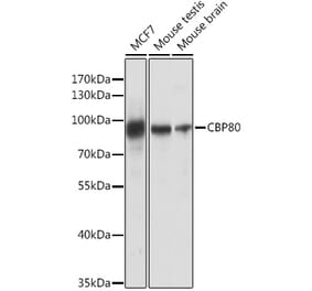 Western Blot - Anti-CBP80 Antibody (A91672) - Antibodies.com