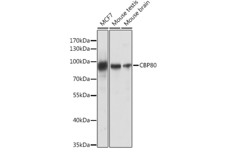 Western Blot - Anti-CBP80 Antibody (A91672) - Antibodies.com