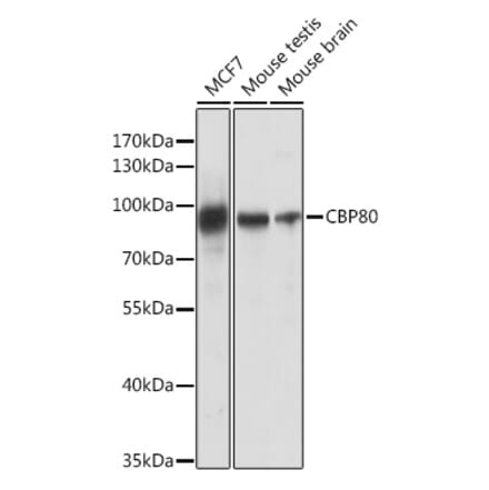 Western Blot - Anti-CBP80 Antibody (A91672) - Antibodies.com