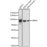 Western Blot - Anti-CBP80 Antibody (A91672) - Antibodies.com