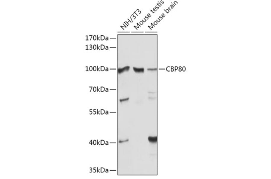 Western Blot - Anti-CBP80 Antibody (A91672) - Antibodies.com