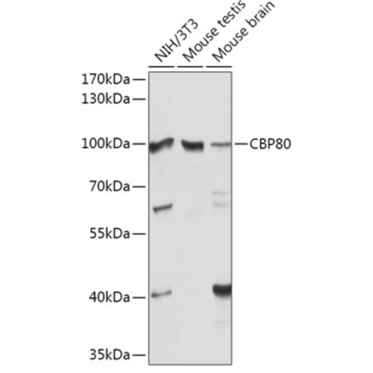 Western Blot - Anti-CBP80 Antibody (A91672) - Antibodies.com