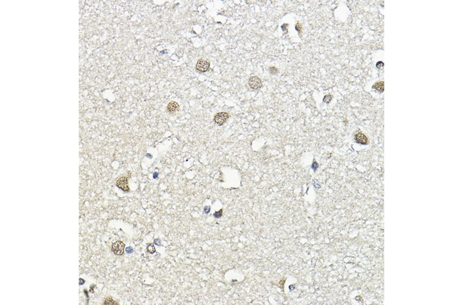 Immunohistochemistry - Anti-CBP80 Antibody (A91672) - Antibodies.com