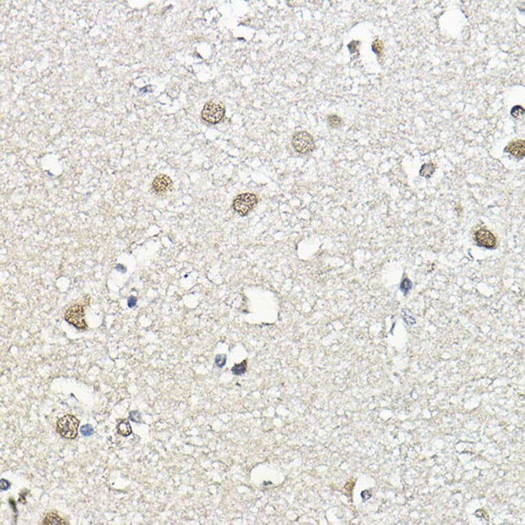 Immunohistochemistry - Anti-CBP80 Antibody (A91672) - Antibodies.com