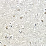 Immunohistochemistry - Anti-CBP80 Antibody (A91672) - Antibodies.com