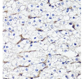 Immunohistochemistry - Anti-CD44 Antibody (A91673) - Antibodies.com
