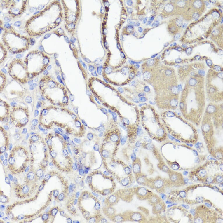 Immunohistochemistry - Anti-CD44 Antibody (A91673) - Antibodies.com