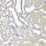 Immunohistochemistry - Anti-CD44 Antibody (A91673) - Antibodies.com