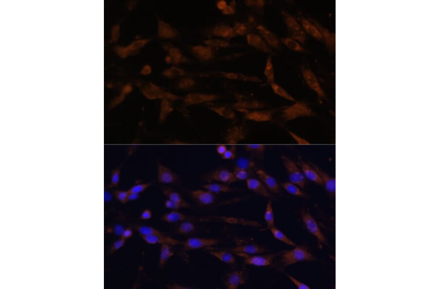 Immunofluorescence - Anti-CD44 Antibody (A91673) - Antibodies.com