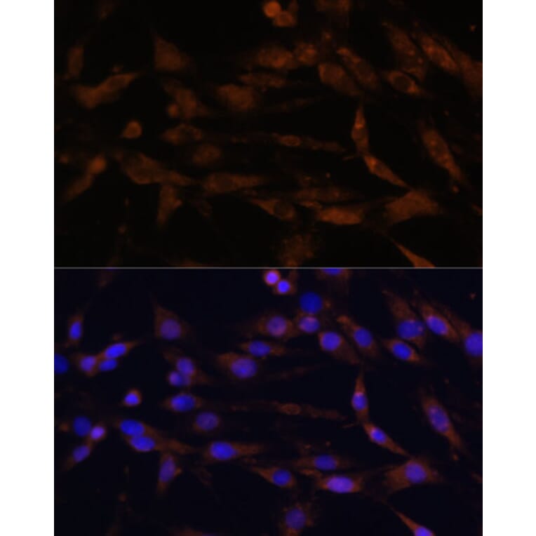 Immunofluorescence - Anti-CD44 Antibody (A91673) - Antibodies.com