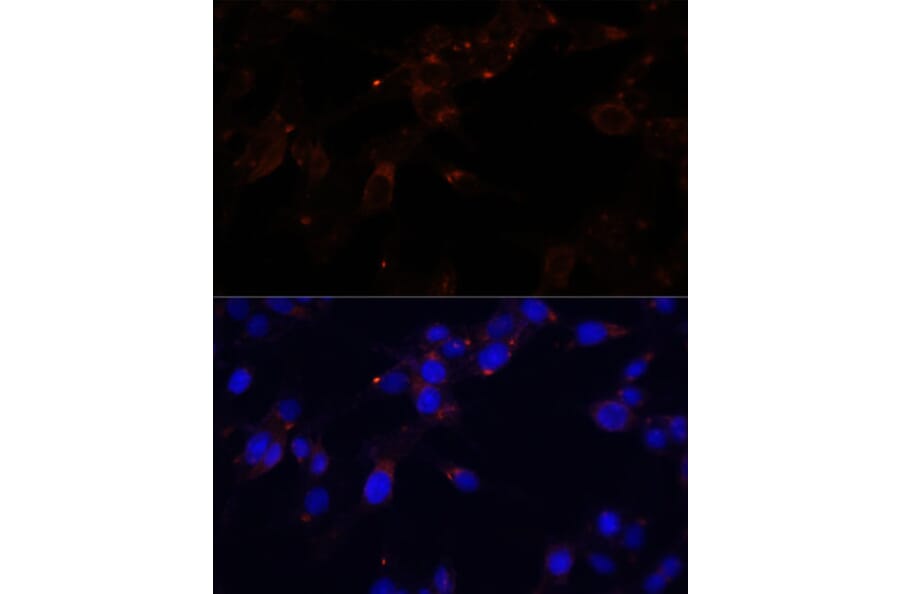 Immunofluorescence - Anti-CD44 Antibody (A91673) - Antibodies.com
