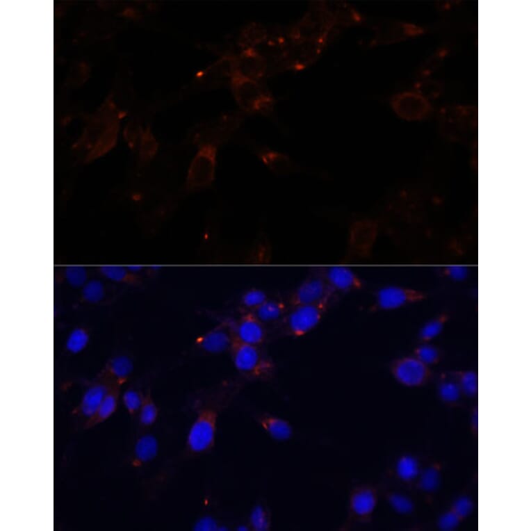 Immunofluorescence - Anti-CD44 Antibody (A91673) - Antibodies.com
