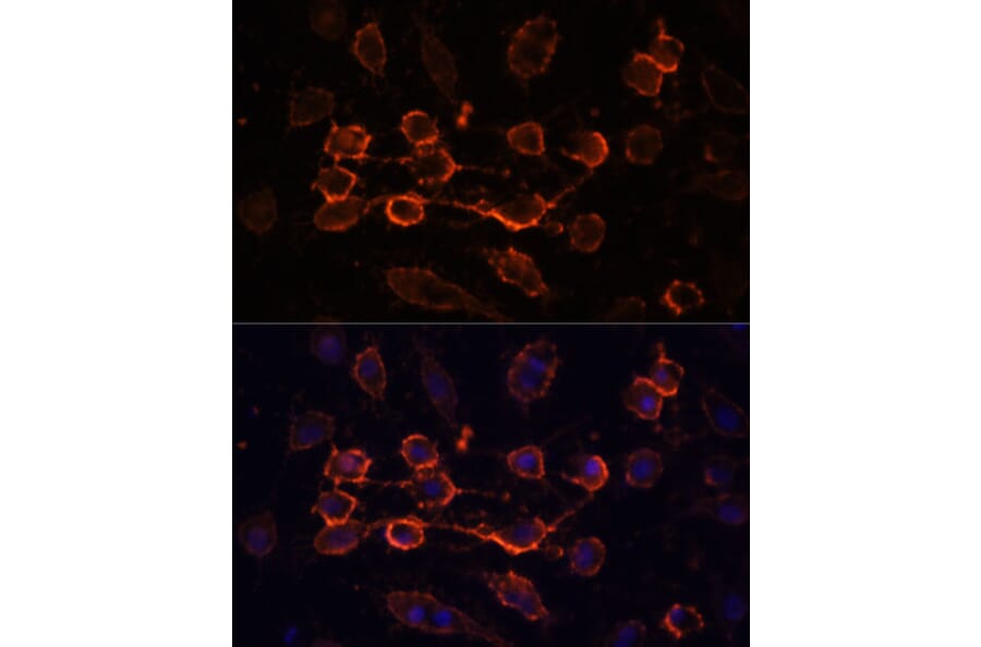 Immunofluorescence - Anti-CD44 Antibody (A91673) - Antibodies.com