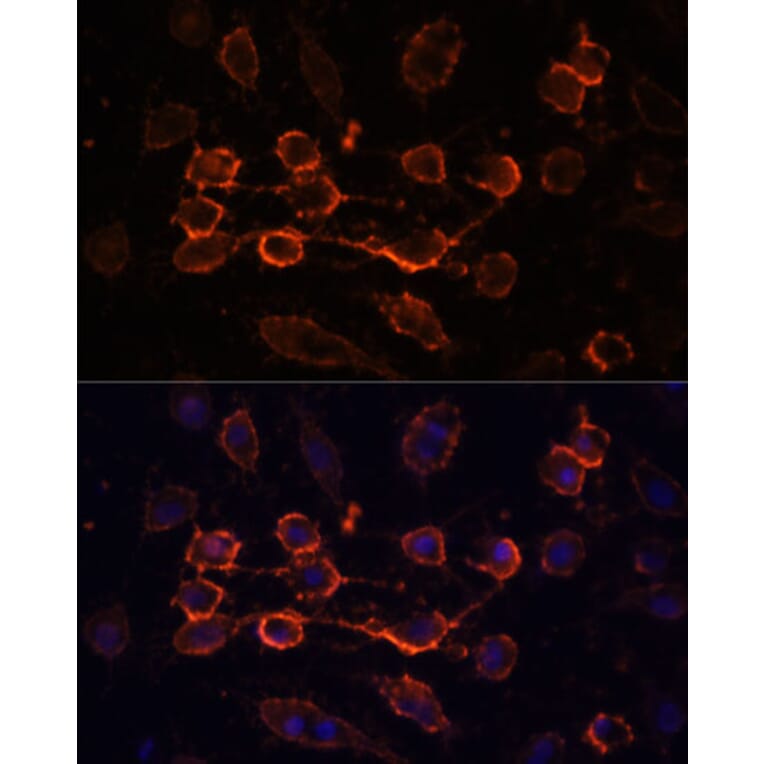 Immunofluorescence - Anti-CD44 Antibody (A91673) - Antibodies.com