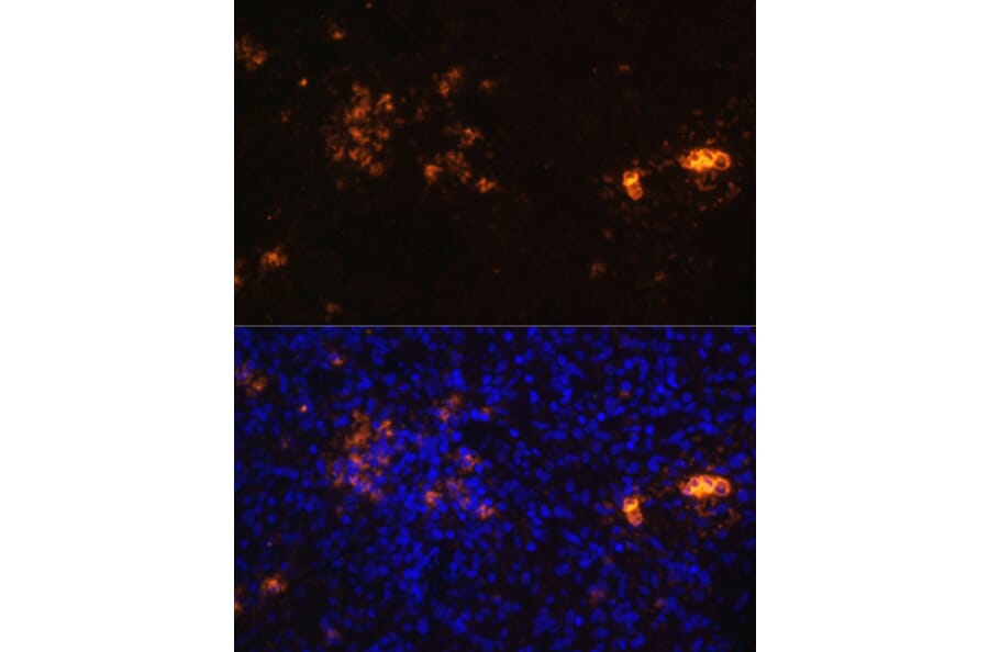 Immunofluorescence - Anti-CD70 Antibody (A91674) - Antibodies.com