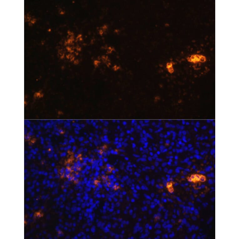Immunofluorescence - Anti-CD70 Antibody (A91674) - Antibodies.com