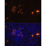 Immunofluorescence - Anti-CD70 Antibody (A91674) - Antibodies.com