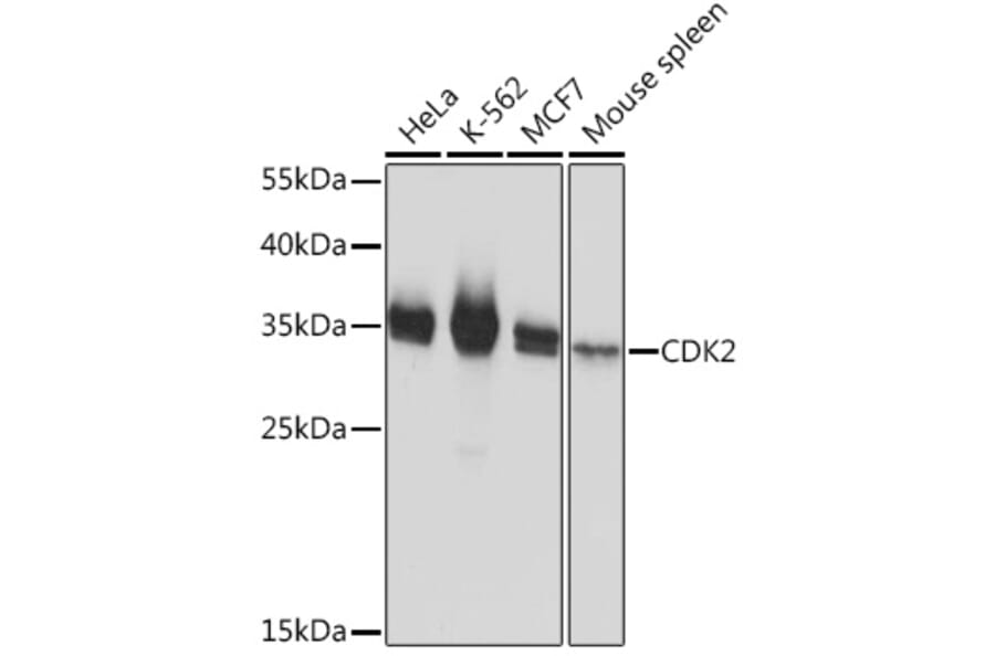 Western Blot - Anti-CDK2 Antibody (A91675) - Antibodies.com