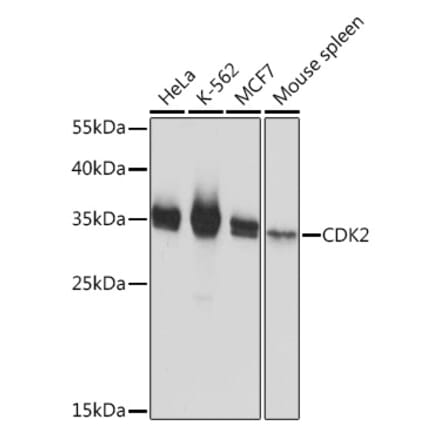 Western Blot - Anti-CDK2 Antibody (A91675) - Antibodies.com