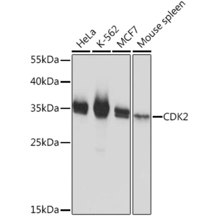 Western Blot - Anti-CDK2 Antibody (A91675) - Antibodies.com