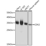 Western Blot - Anti-CDK2 Antibody (A91675) - Antibodies.com