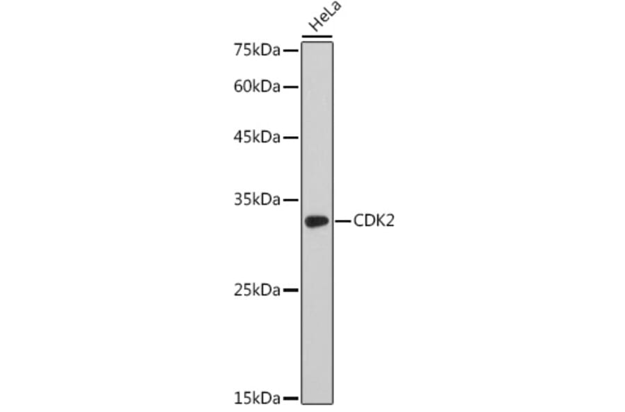 Western Blot - Anti-CDK2 Antibody (A91675) - Antibodies.com
