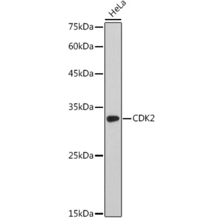 Western Blot - Anti-CDK2 Antibody (A91675) - Antibodies.com