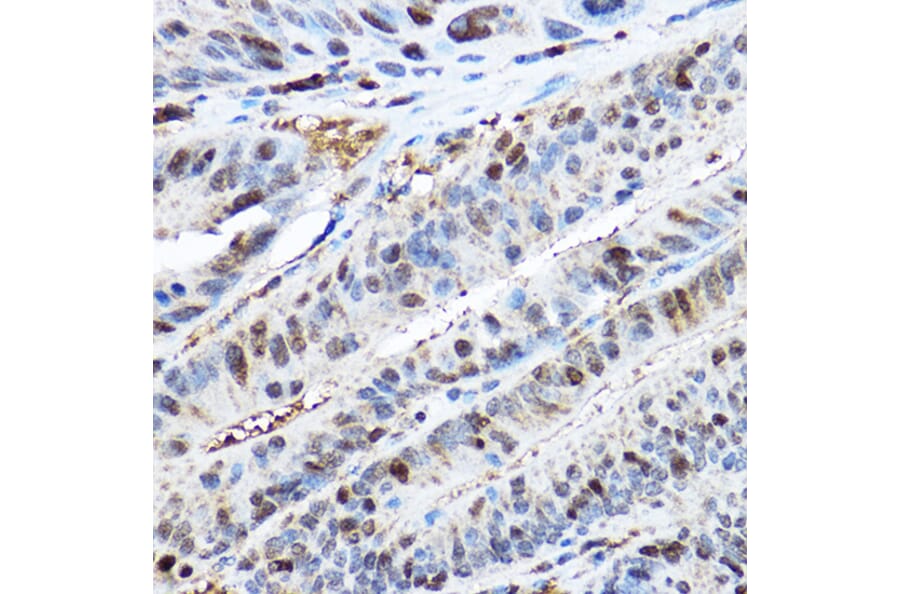 Immunohistochemistry - Anti-CDK2 Antibody (A91675) - Antibodies.com