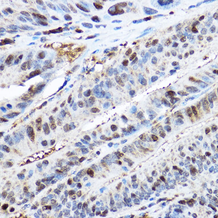 Immunohistochemistry - Anti-CDK2 Antibody (A91675) - Antibodies.com