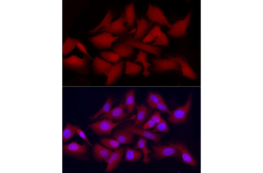Immunofluorescence - Anti-CDK2 Antibody (A91675) - Antibodies.com