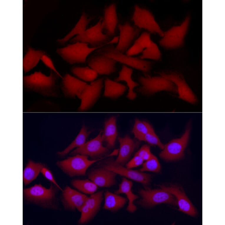 Immunofluorescence - Anti-CDK2 Antibody (A91675) - Antibodies.com