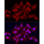 Immunofluorescence - Anti-CDK2 Antibody (A91675) - Antibodies.com