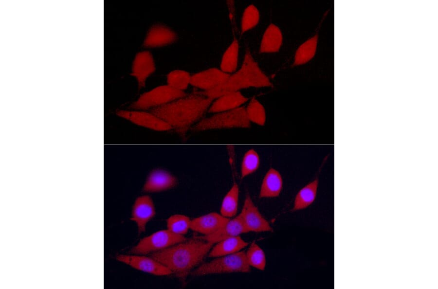 Immunofluorescence - Anti-CDK2 Antibody (A91675) - Antibodies.com