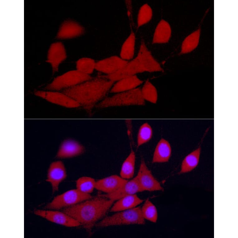 Immunofluorescence - Anti-CDK2 Antibody (A91675) - Antibodies.com