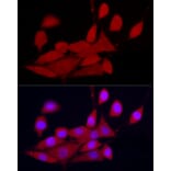 Immunofluorescence - Anti-CDK2 Antibody (A91675) - Antibodies.com